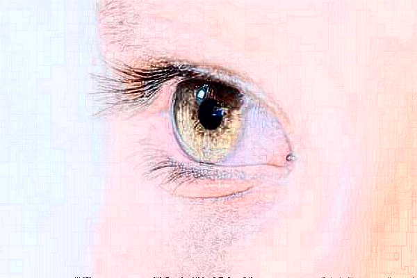 無(wú)錫市人民醫(yī)院全飛秒好嗎?附價(jià)格表+案例