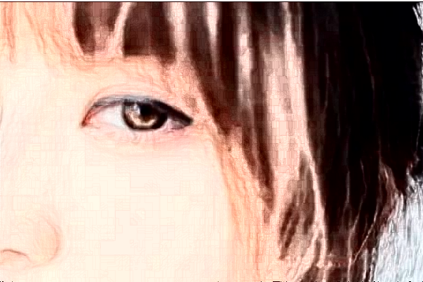 無(wú)錫市人民醫(yī)院全飛秒好嗎?附價(jià)格表+案例