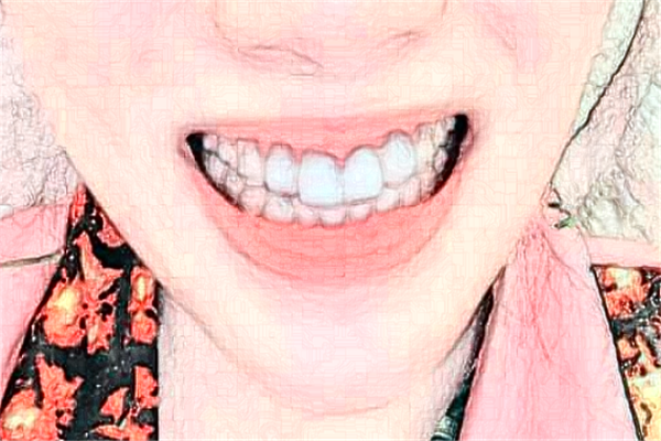 北京牙管家口腔診所超聲波洗牙怎么樣|醫(yī)生介紹|價(jià)格收費(fèi)