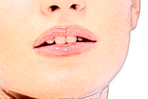 鄭州唯美口腔醫(yī)院