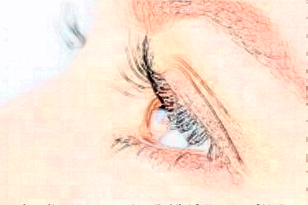 2024遼寧省人民醫(yī)院全飛秒費(fèi)用多少?整形日記全過程