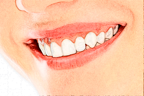 河南美奧口腔醫(yī)院醫(yī)生技術怎么樣?2024牙齒矯正收費多少