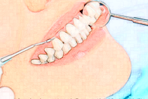 2024鄭州植得口腔醫(yī)院牙美白多少錢?牙齒美白修復(fù)多少錢