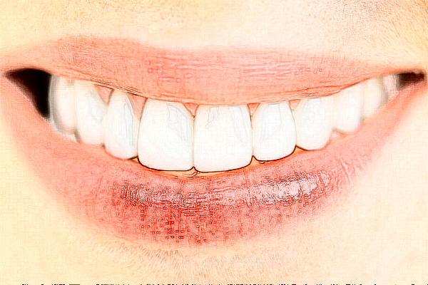 鄭州植得口腔醫(yī)院矯正牙齒靠譜嗎?2024矯正牙齒價(jià)格