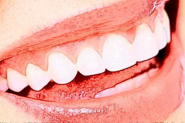 中山香山口腔醫(yī)院烤瓷牙怎么樣?烤瓷牙能用多少年