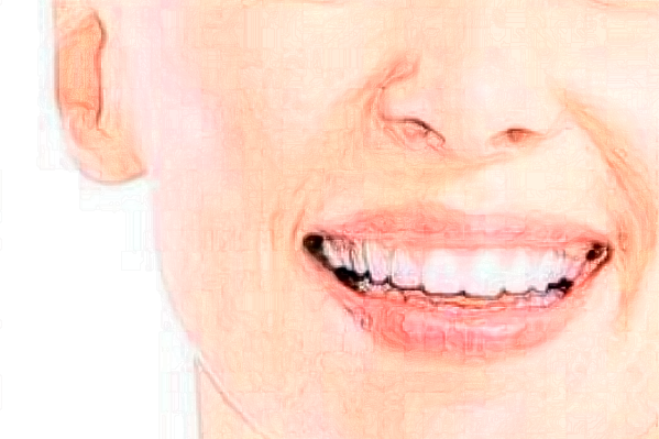 2024淮安諾貝爾口腔醫(yī)院瓷貼面哪個(gè)醫(yī)生好?專家名單+案例反饋