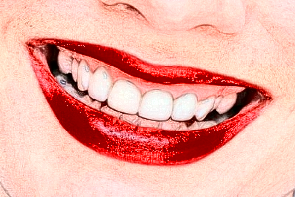 鄭州唯美口腔醫(yī)院美容冠價(jià)格多少?整形日記全過(guò)程分享