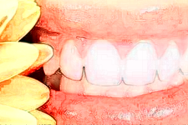 長(zhǎng)沙科爾雅口腔醫(yī)院隱適美案例_專(zhuān)家介紹