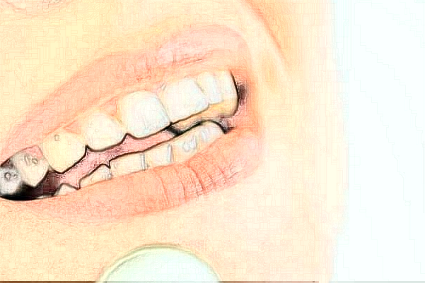 長(zhǎng)沙科爾雅口腔醫(yī)院隱適美案例_專(zhuān)家介紹