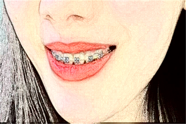 2024杭州雅萊口腔牙綜合怎么樣?哪個醫(yī)生好