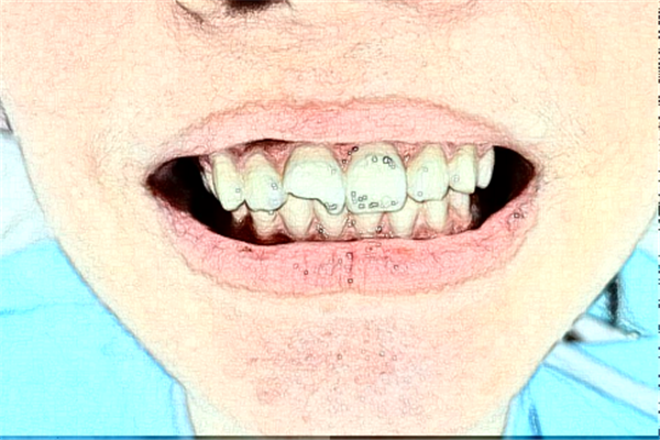 2024杭州雅萊口腔牙綜合怎么樣?哪個醫(yī)生好