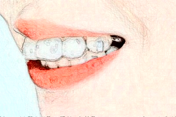 成都茁悅口腔牙齒美白怎么樣_專家信息_案例大全