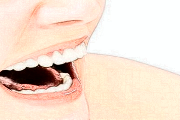 成都茁悅口腔牙齒美白怎么樣_專家信息_案例大全