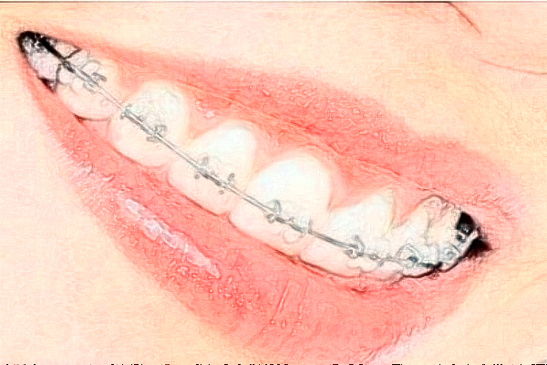 北京牙管家口腔診所虎牙矯正怎么樣_專家信息_案例大全欣賞