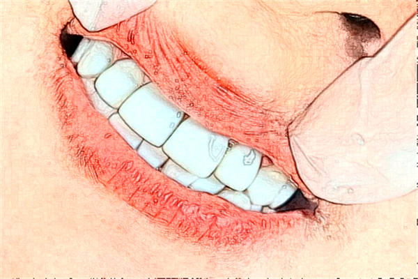 2024貴陽柏德口腔醫(yī)院齙牙矯正怎么樣_體驗(yàn)日記分享