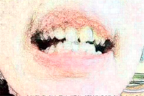 2024貴陽柏德口腔醫(yī)院齙牙矯正怎么樣_體驗(yàn)日記分享