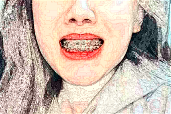 2024福州美橙口腔牙列擁擠矯正哪個醫(yī)生好?專家名單+案例反饋