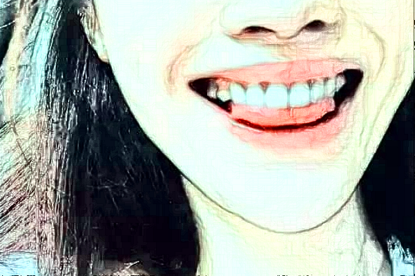 重慶維樂(lè)口腔醫(yī)院隱形矯正適合人群?隱形矯正的優(yōu)勢(shì)