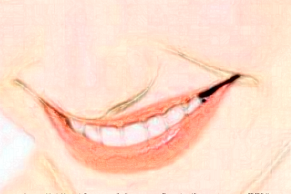 義烏傅氏口腔門診部拔牙痛不痛?拔牙需要多少時(shí)間