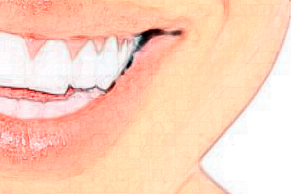 贛州貝殼口腔拔牙怎么樣，附醫(yī)生信息一覽~