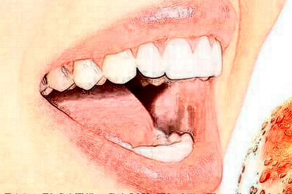 2024昆明雅度口腔門診部醫(yī)生團(tuán)隊(duì)_案例