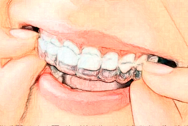 2024昆明雅度口腔門診部醫(yī)生團(tuán)隊(duì)_案例