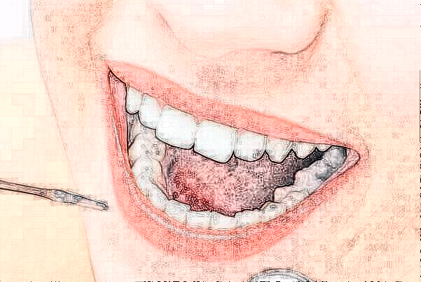 2024北京開顏口腔診所牙齒矯正價格表(價目表)怎么樣