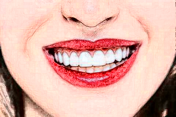 2024福州登特口腔醫(yī)院正畸怎么樣_體驗(yàn)日記分享