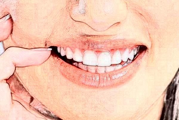 杭州植得口腔門診部牙體牙髓怎么樣?醫(yī)生介紹_案例分享