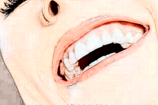 北京開顏口腔診所種植牙怎么樣|醫(yī)生介紹|價格收費(fèi)