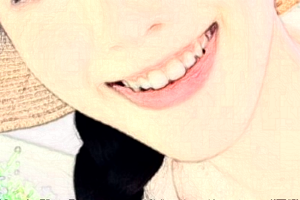 淮安諾貝爾口腔醫(yī)院隱形矯正怎么樣，附醫(yī)生信息一覽~