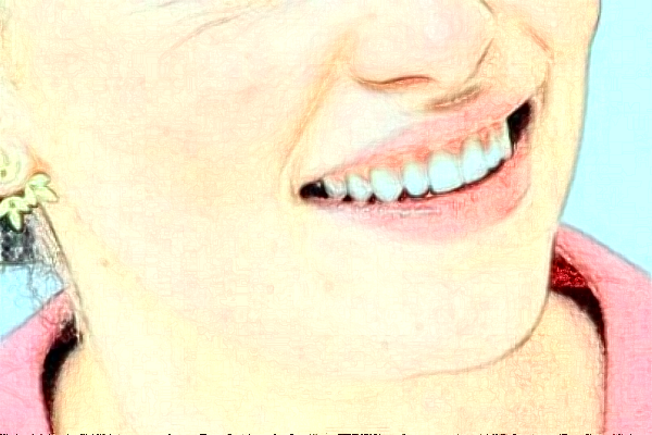 淮安諾貝爾口腔醫(yī)院隱形矯正怎么樣，附醫(yī)生信息一覽~