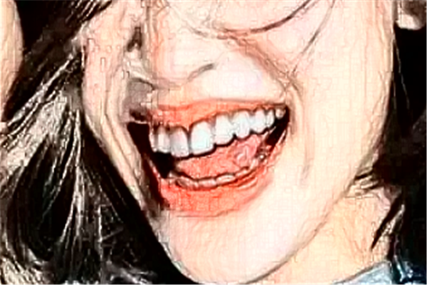 重慶齊美口腔門診部虎牙矯正好么?醫(yī)生推薦+整形案例參考~