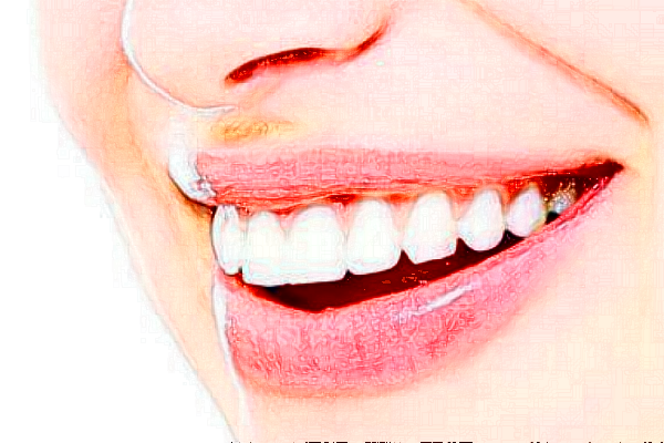 昆明雅度口腔醫(yī)院補(bǔ)牙怎么樣_體驗(yàn)日記分享