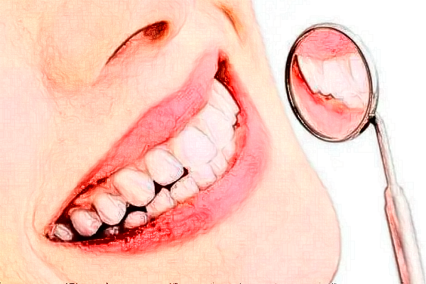 昆明雅度口腔醫(yī)院補(bǔ)牙怎么樣_體驗(yàn)日記分享