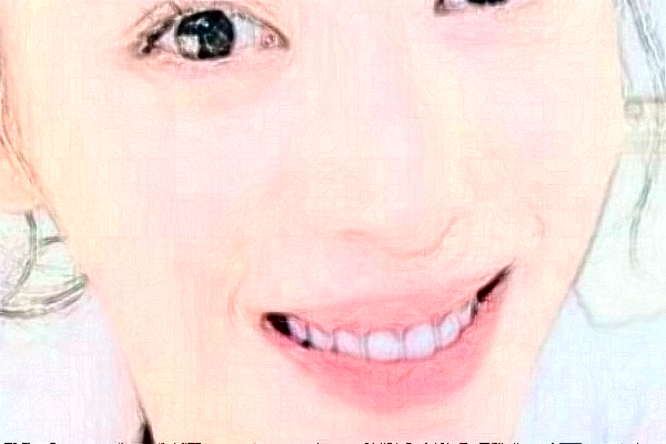 2024太原眾牙口腔醫(yī)院烤瓷牙價格多少?整形日記全過程分享