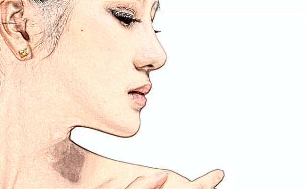 重慶軍科整形美容醫(yī)院玻尿酸填充一年親測案例全解|技術特色怎么樣?費用多少