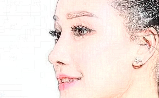 鞍山燕麗美容醫(yī)院抗衰除皺價目表?技術(shù)評測&90天案例揭秘