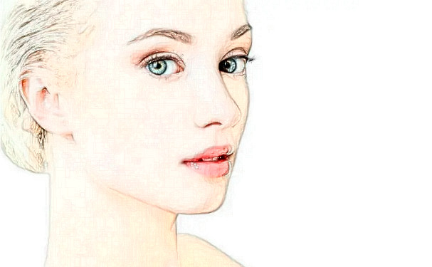 寧波米陽整形醫(yī)院玻尿酸填充臉部術(shù)后半年求美案例|技術(shù)水準(zhǔn)怎么樣?價目一覽表