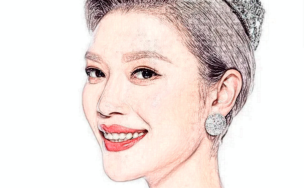 麗水黃君曼整形醫(yī)院去頸紋技術(shù)怎么樣?費用查詢?半年親測案例全解