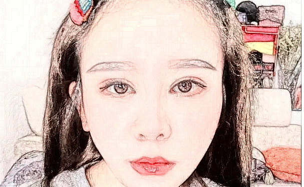 長(zhǎng)沙麗臻醫(yī)療美容門診激光除皺技術(shù)等級(jí)怎么樣?術(shù)后90天案例&價(jià)格