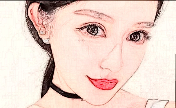 成都美容整形醫(yī)院招風(fēng)耳矯正技術(shù)怎么樣?術(shù)后三個月恢復(fù)案例|價目表