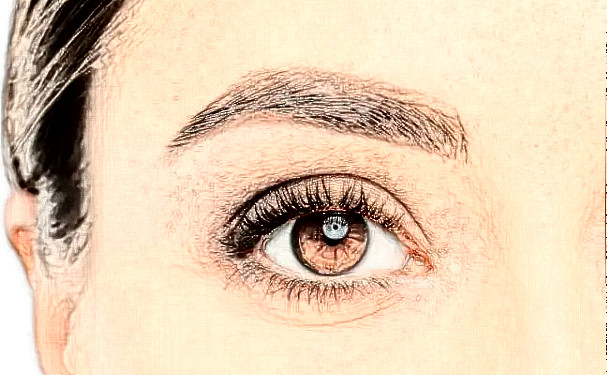 新疆千禧麗人整形美容?？漆t(yī)院耳朵整形術(shù)后半年恢復(fù)案例|技術(shù)亮點(diǎn)怎么樣?價(jià)格多少