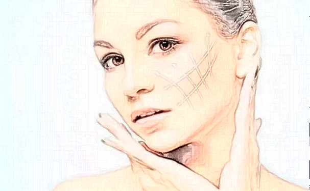 廣州市白云區(qū)第一人民醫(yī)院創(chuàng)傷整形外科耳朵矯正技術(shù)怎么樣?150天術(shù)后案例展示|收費(fèi)標(biāo)準(zhǔn)