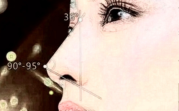 深圳港丹醫(yī)療美容門診部膨體隆鼻收費多少?120天恢復(fù)案例