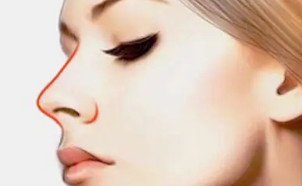 華中科技大學(xué)同濟醫(yī)學(xué)院醫(yī)院肋骨鼻技術(shù)怎么樣?120天親測案例全解