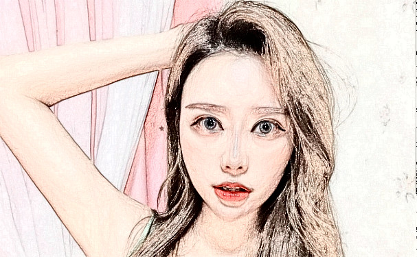 泉州豐澤脂管加醫(yī)療美容門診部整鼻子技術(shù)特點怎么樣?術(shù)后一年恢復(fù)案例