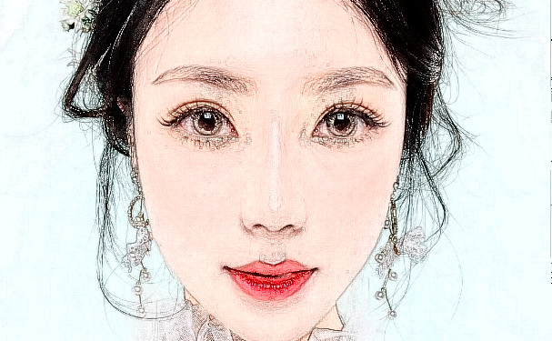 華中科技大學同濟醫(yī)學院醫(yī)院整鼻子三個月術后恢復案例&技術怎么樣?