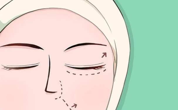 檸悅美容整形做腫泡眼雙眼皮技術(shù)怎么樣?費(fèi)用查詢(xún)?術(shù)后半年案例點(diǎn)評(píng)