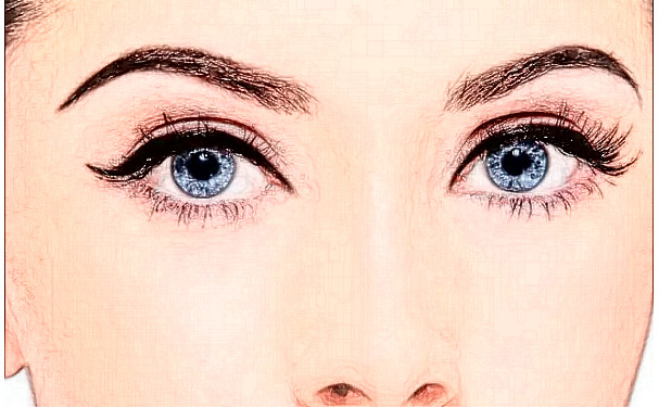 邵陽曹家醫(yī)療美容門診部雙眼皮技術(shù)怎么樣?價格?術(shù)后半年案例